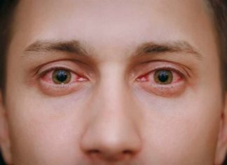 Почему краснеют глаза к вечеру?