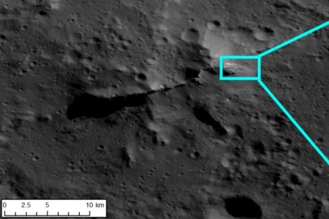 Ученые подтвердили наличие аномалий в мозге переболевших коронавирусом