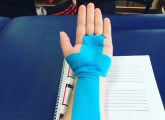 Тейпирование: современная методика восстановления