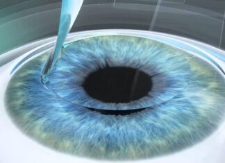 Популярные методы лазерной коррекции зрения
