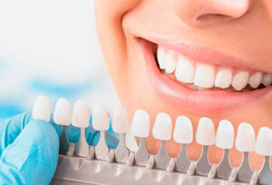 Современные методы эстетической стоматологии