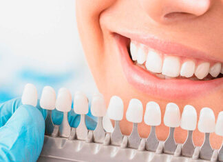 Современные методы эстетической стоматологии