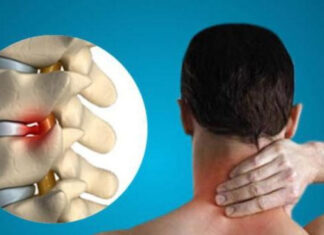 Особенности остеохондроза и грыжи шейного отдела позвоночника