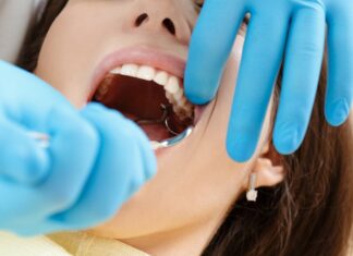Что нужно знать пациентам об удалении зубов