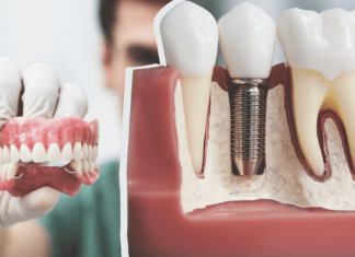 Что такое зубные протезы и как за ними ухаживать?