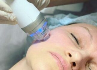 Плюсы и назначение игольчатого RF-лифтинга