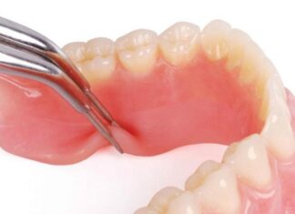 Преимущества и условия установки зубного протеза с эластичной подкладкой