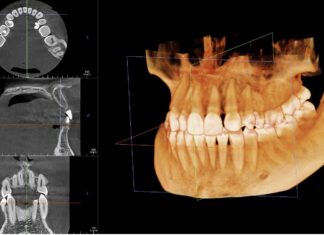 Когда и как проводится компьютерная томография зубов в Москве