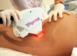 Лазерная шлифовка растяжек: эффективное решение проблемы несовершенств кожи